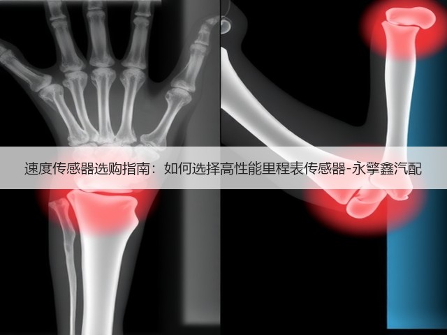 速度传感器选购指南：如何选择高性能里程表传感器-永擎鑫汽配(图3)