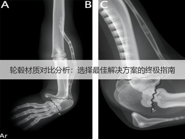 轮毂材质对比分析:选择最佳解决方案的终极指南(图1) 轮毂材质对比分析:选择最佳解决方案的终极指南(图1)