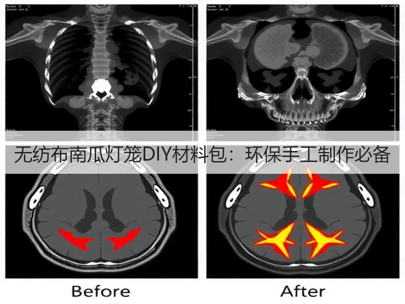无纺布南瓜灯笼DIY材料包：环保手工制作必备